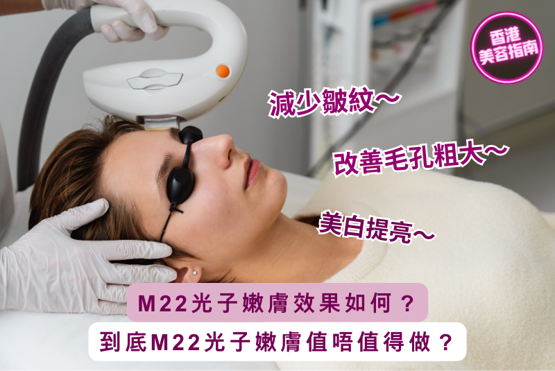 M22光子嫩膚效果如何？值得做嗎？